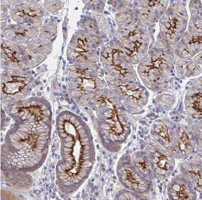 Immunohistochemistry-Paraffin: Somatostatin R1/SSTR1 Antibody [NBP2-34203]