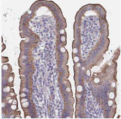 Immunohistochemistry-Paraffin: Somatostatin R1/SSTR1 Antibody [NBP2-34203]