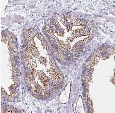 Immunohistochemistry-Paraffin: Somatostatin R1/SSTR1 Antibody [NBP2-34203]