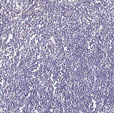 Immunohistochemistry-Paraffin: Somatostatin R1/SSTR1 Antibody [NBP2-34203]