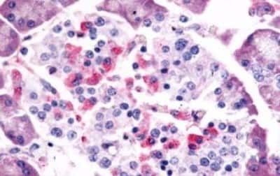 Immunohistochemistry-Paraffin: Somatostatin R1/SSTR1 Antibody [NBP3-14480]