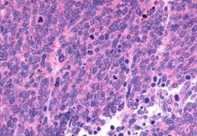 Immunohistochemistry-Paraffin: Somatostatin R1/SSTR1 Antibody [NBP3-14480]