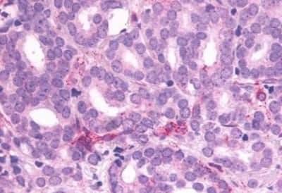 Immunohistochemistry-Paraffin: Somatostatin R1/SSTR1 Antibody [NBP3-14480]