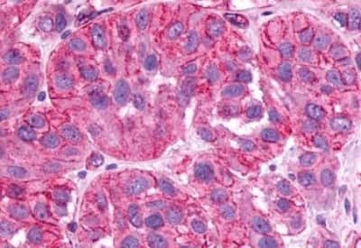 Immunohistochemistry-Paraffin: Somatostatin R1/SSTR1 Antibody [NBP3-14480]