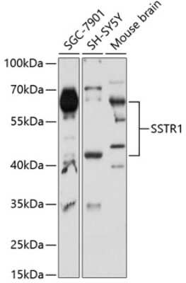 Western Blot: Somatostatin R1/SSTR1 AntibodyBSA Free [NBP2-93629]