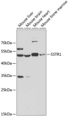 Western Blot: Somatostatin R1/SSTR1 AntibodyAzide and BSA Free [NBP2-94605]