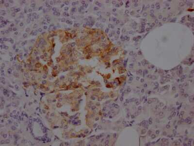 Immunohistochemistry: Somatostatin R2/SSTR2 Antibody (1C3) [NBP3-15215]