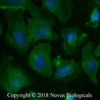 Immunocytochemistry/ Immunofluorescence: Somatostatin R2/SSTR2 Antibody [NB300-157]