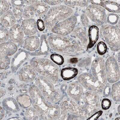 Immunohistochemistry-Paraffin: Somatostatin R2/SSTR2 Antibody [NBP2-48508]