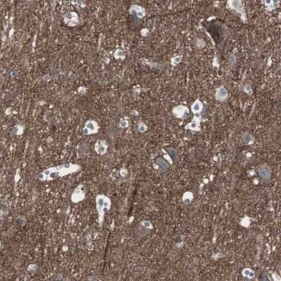 Immunohistochemistry-Paraffin: Somatostatin R2/SSTR2 Antibody [NBP2-48508]