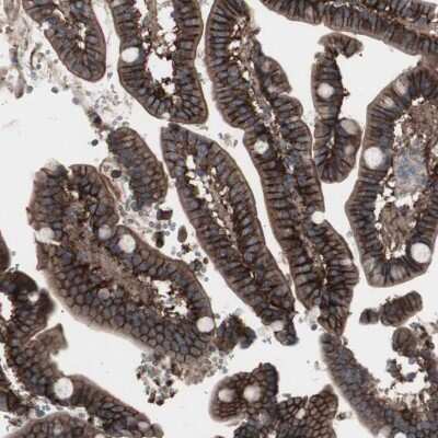 Immunohistochemistry-Paraffin: Somatostatin R2/SSTR2 Antibody [NBP2-48508]