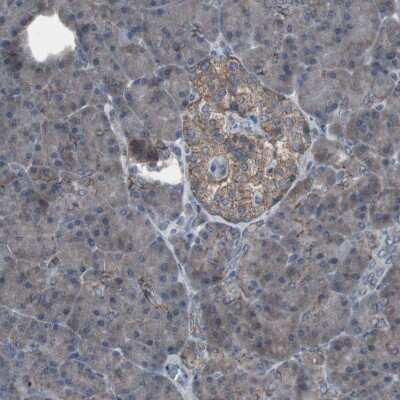 Immunohistochemistry-Paraffin: Somatostatin R2/SSTR2 Antibody [NBP2-48508]
