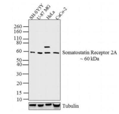 Western Blot: Somatostatin R2/SSTR2 Antibody [NB100-74537]