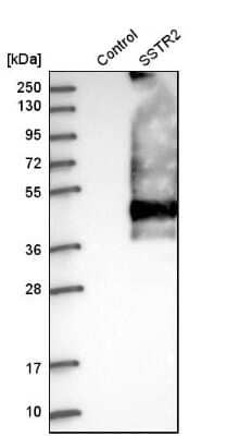 Western Blot: Somatostatin R2/SSTR2 Antibody [NBP2-48508]