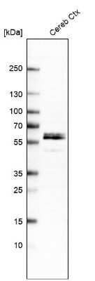 Western Blot: Somatostatin R2/SSTR2 Antibody [NBP2-48508]