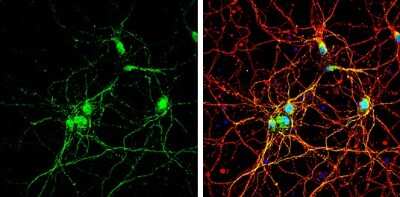 Immunocytochemistry/ Immunofluorescence: Somatostatin R3/SSTR3 Antibody [NBP3-12903]