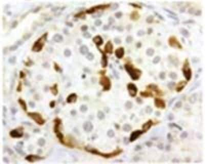 Immunohistochemistry-Paraffin: Somatostatin R3/SSTR3 Antibody [NB100-74538]