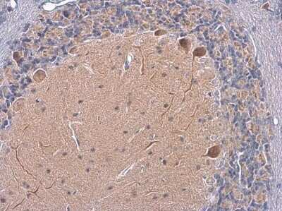 Immunohistochemistry-Paraffin: Somatostatin R3/SSTR3 Antibody [NBP3-12903]