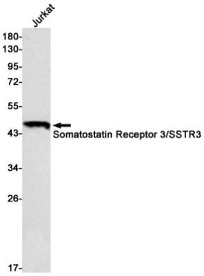 Western Blot: Somatostatin R3/SSTR3 Antibody (S08-2G8) [NBP3-19777]