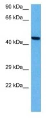 Western Blot: Somatostatin R3/SSTR3 Antibody [NBP3-10032]