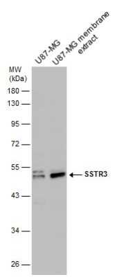 Western Blot: Somatostatin R3/SSTR3 Antibody [NBP3-12903]