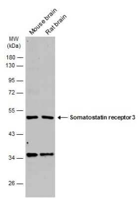 Western Blot: Somatostatin R3/SSTR3 Antibody [NBP3-12903]