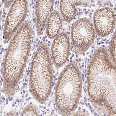 Immunohistochemistry-Paraffin: Somatostatin R4/SSTR4 Antibody [NBP2-39022]