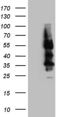 Western Blot: Somatostatin R4/SSTR4 Antibody (OTI2F11)Azide and BSA Free [NBP2-74283]