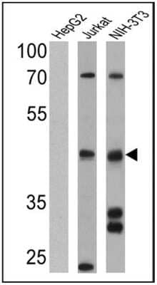 Western Blot: Somatostatin R4/SSTR4 Antibody [NB100-74539]