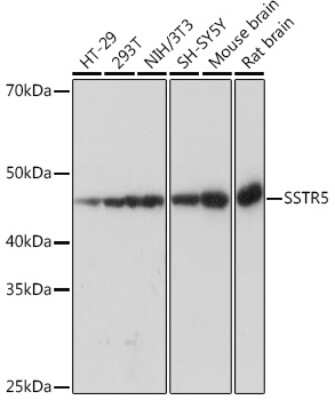 Western Blot: Somatostatin R5/SSTR5 Antibody (4O6N5) [NBP3-16682]