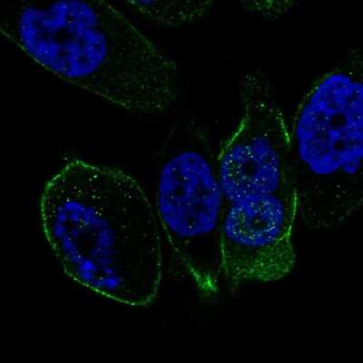 Immunocytochemistry/ Immunofluorescence: Somatostatin R5/SSTR5 Antibody [NBP2-56513]