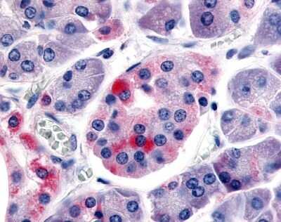 Immunohistochemistry-Paraffin: Somatostatin R5/SSTR5 Antibody - BSA Free [NLS4419]