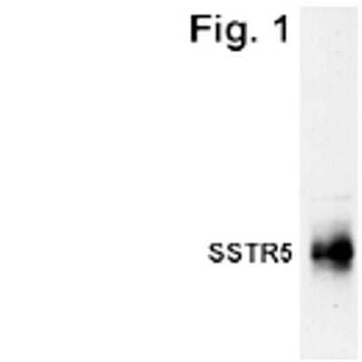 Western Blot: Somatostatin R5/SSTR5 Antibody [NB100-74540]