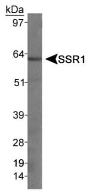 Western Blot: Somatostatin R1/SSTR1 Antibody [NB300-120]