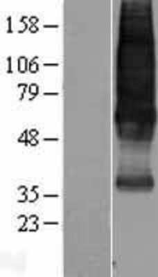 Western Blot: Somatostatin R1/SSTR1 Overexpression Lysate [NBL1-16477]