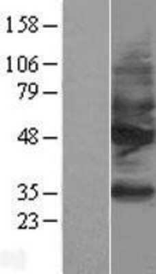 Western Blot: Somatostatin R2/SSTR2 Overexpression Lysate [NBL1-16478]