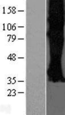 Western Blot: Somatostatin R3/SSTR3 Overexpression Lysate [NBP2-10911]