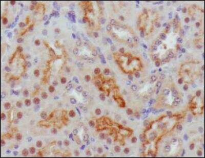 Immunohistochemistry: Sonic Hedgehog/Shh Antibody - BSA Free [NBP2-22139]
