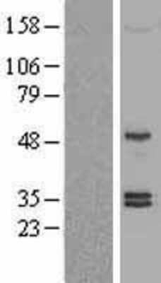 Western Blot: Sonic Hedgehog/Shh Overexpression Lysate [NBL1-15941]