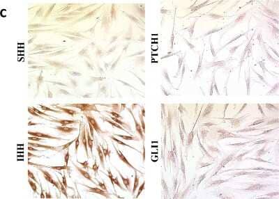 Immunocytochemistry/ Immunofluorescence: Sonic Hedgehog/Shh Antibody (5H4) [NBP2-22126]