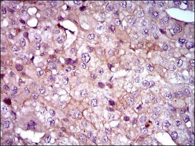 Immunohistochemistry-Paraffin: Sonic Hedgehog/Shh Antibody (5H4) [NBP2-22126]