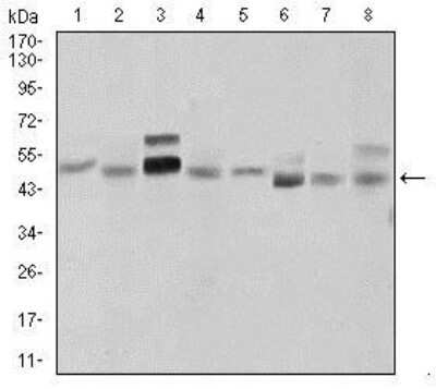 Western Blot: Sonic Hedgehog/Shh Antibody (5H4) [NBP2-22126]