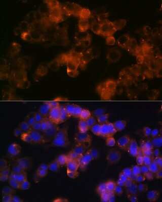 Immunocytochemistry/ Immunofluorescence: Sonic Hedgehog/Shh Antibody (8T4D3) [NBP3-15454]