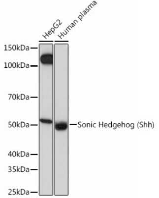 Western Blot: Sonic Hedgehog/Shh Antibody (8T4D3) [NBP3-15454]