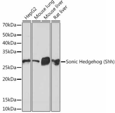 Western Blot: Sonic Hedgehog/Shh Antibody (8T4D3) [NBP3-15454]