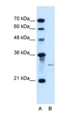 Western Blot: Sonic Hedgehog/Shh Antibody [NBP1-69270]