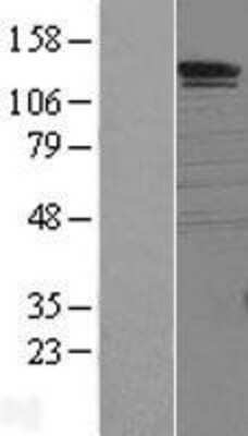 Western Blot: SorCS1 Overexpression Lysate [NBL1-16338]