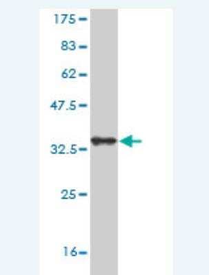 Western Blot: SorCS3 Antibody (3B12) [H00022986-M01]