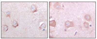 Immunohistochemistry-Paraffin: SorLA Antibody (3B6B11) - BSA Free [NBP1-28882]
