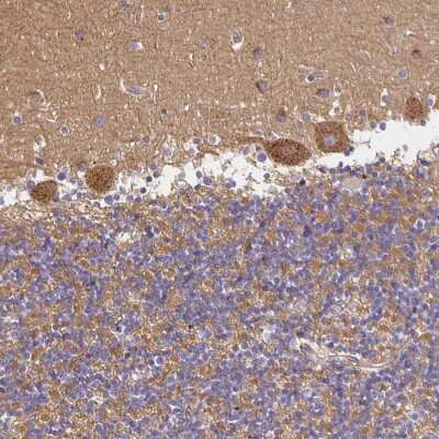 Immunohistochemistry: SorLA Antibody [NBP2-38177]